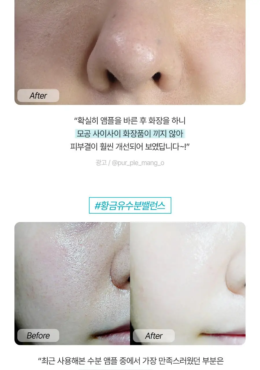 [NEW/리뷰이벤트] 비욘드 엔젤 아쿠아 이온 히알루 10% 수분 가득 진정 앰플 50ml 1+1 기획 상세페이지 7